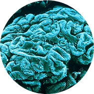 P5500017-Glomerulus_in_the_human_kidney